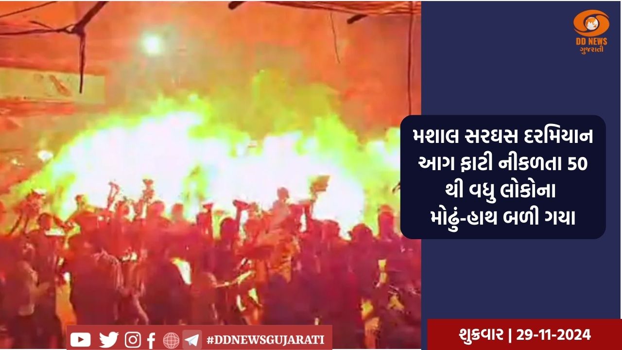 ખંડવામાં માશાલ શોભાયાત્રા દરમિયાન આગ લાગી, મહિલાઓ અને બાળકો સહિત 50 થી વધુ લોકો દાઝ્યા